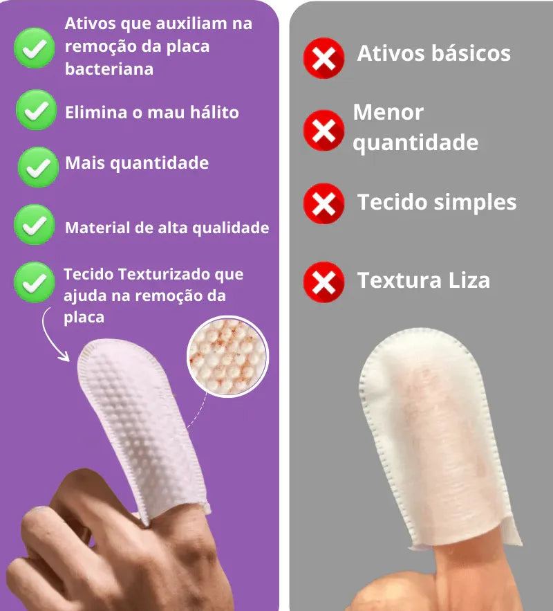 Removedor de tártaro e higienizador | PETCLEAN